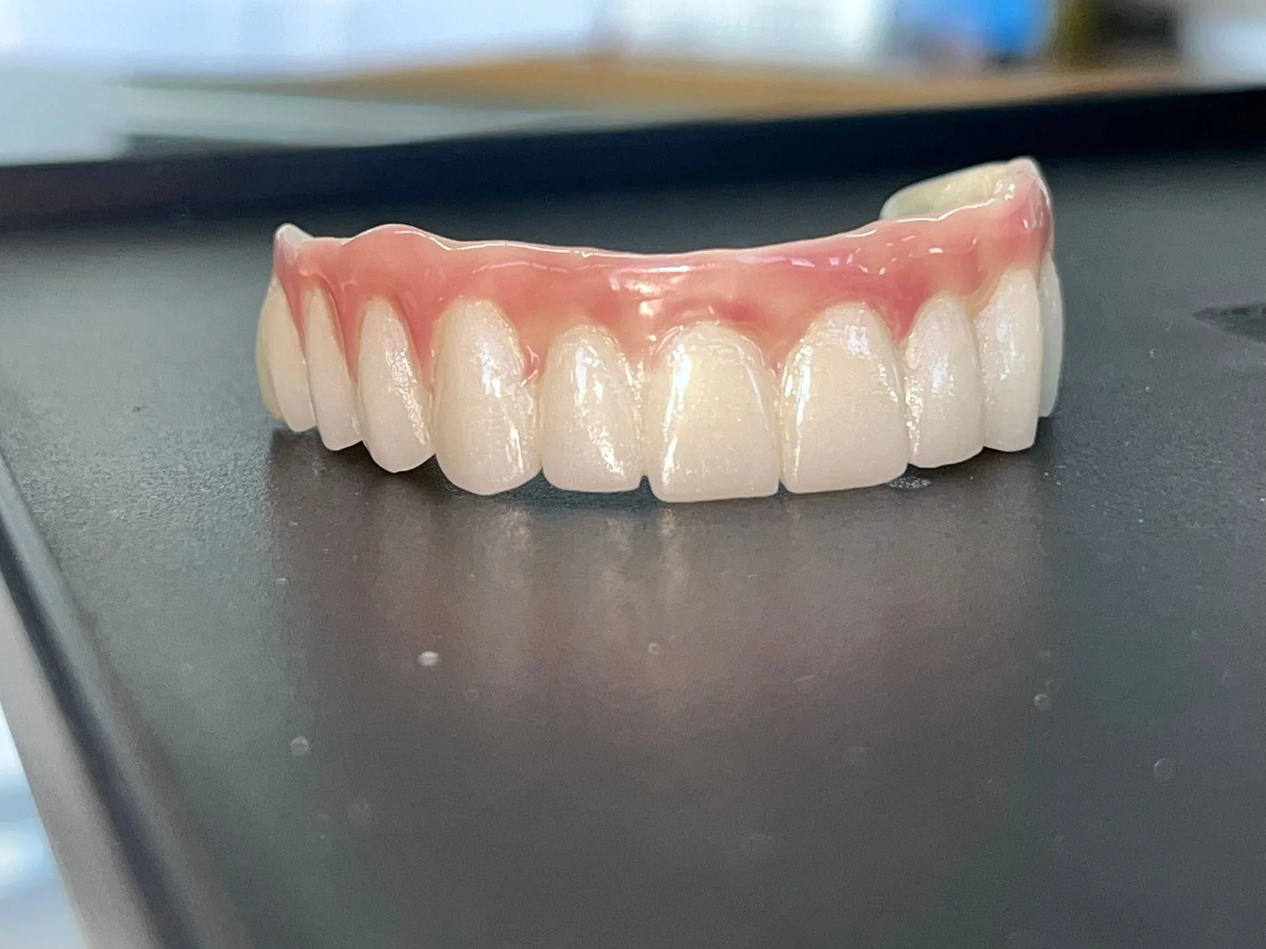 Klinik içi diş laboratuvarı ve dijital planlama